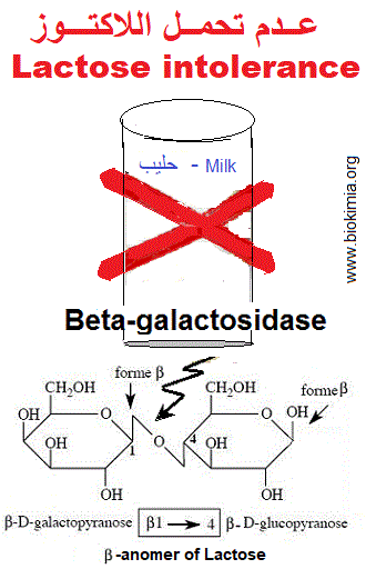 galactosemia