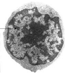 lymphocyte