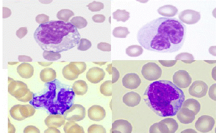 monocyte